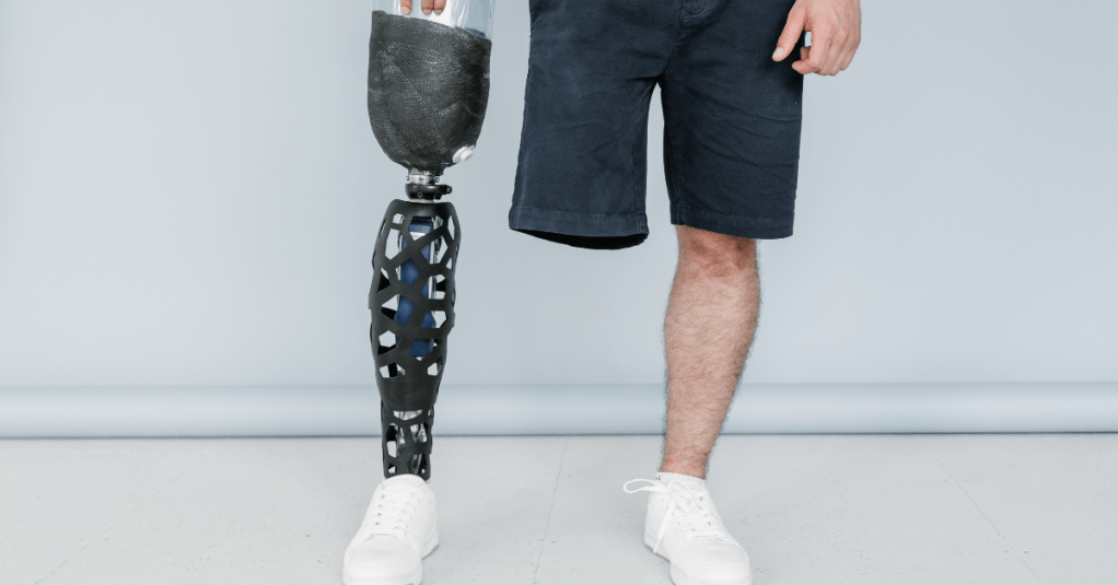 Titanio, carbono y sueños cumplidos: la tecnología que está revolucionando la vida de los&nbsp;amputados