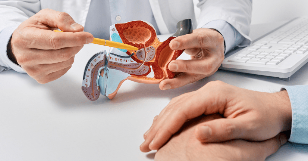 ¿Qué alimentos ayudan a prevenir el cáncer de próstata? La nutrición como aliada de la salud&nbsp;masculina